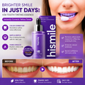 V34 Tooth Colour Corrector Serum — Instant Teeth Whitening | Purple Formula for a Brighter Smile